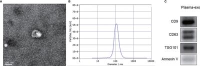 Plasma Exosome-Derived SENP1 May Be a Potential Prognostic Predictor for Melanoma